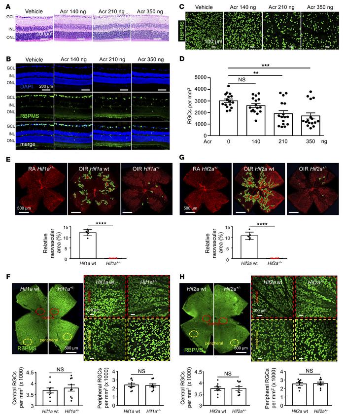 Acriflavine induces retinal cell death.
(A) Representative images of H&a...