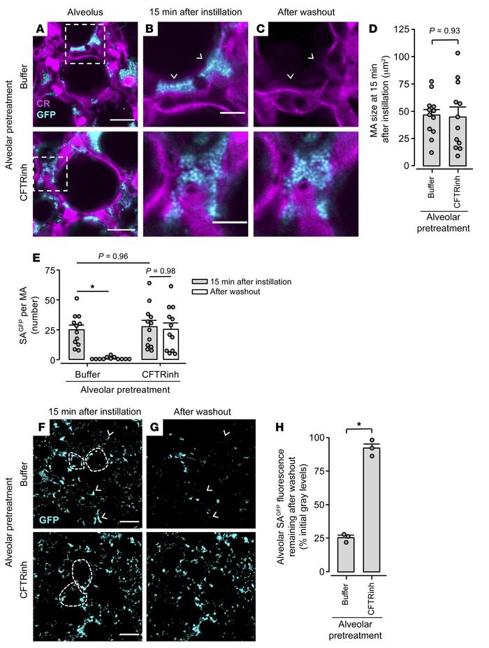 Alveolar epithelial CFTR function protects against alveolar stabilizatio...