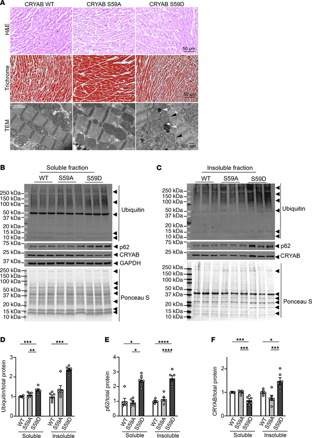 Mice with phosphomimetic aspartic acid residue instead of serine at posi...