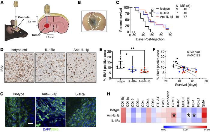 Intratumoral anti–IL-1β antibody or IL-1Ra administration prolongs survi...