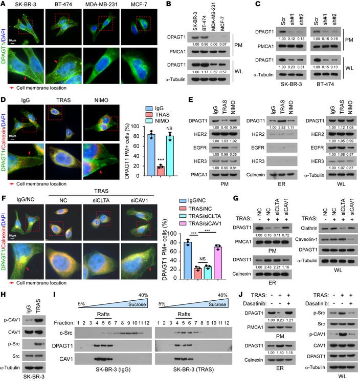 Trastuzumab induces retrograde transport of DPAGT1.
(A) Representative I...