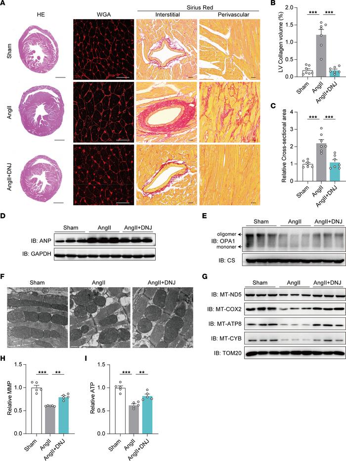 DNJ reverses AngII-induced mitochondrial dysfunction and cardiac hypertr...
