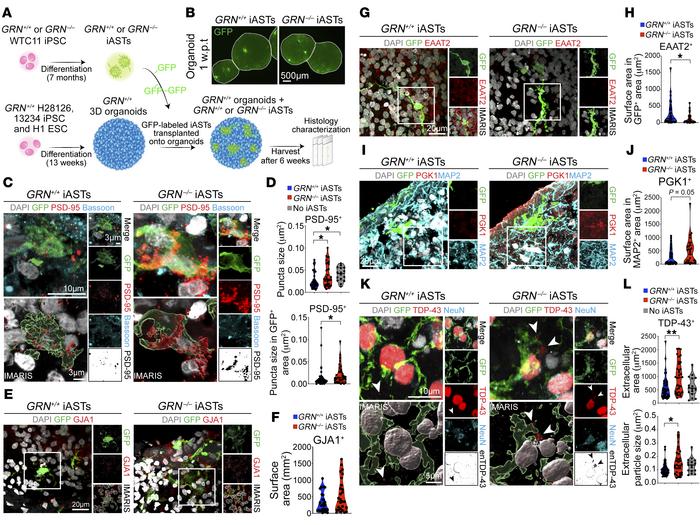 iPSC-derived PGRN-deficient astrocytes fail to promote synaptic refineme...