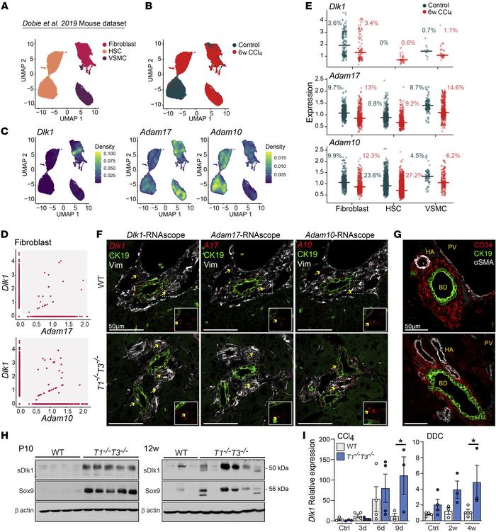 ADAMs and DLK1 are coexpressed in periportal mesenchymal cells.
(A) UMAP...