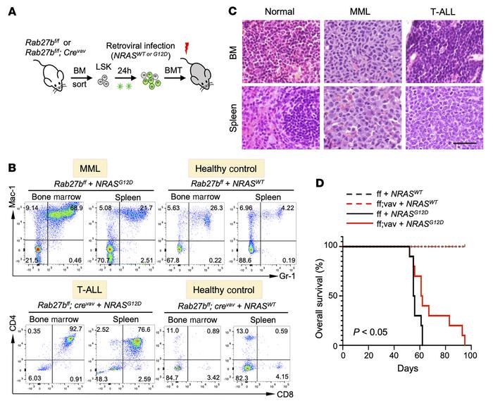 
Rab27b deficiency in mice abrogates oncogenic NRASG12D-mediated myeloid...