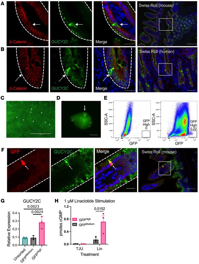 GUCY2C is enriched in a subset of intestinal cells.
(A and B) Immunofluo...