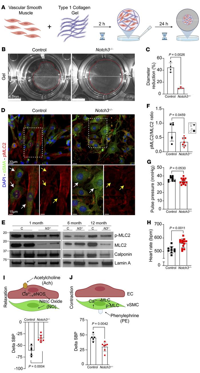 
Notch3 deficiency results in vascular dysfunction due to impaired contr...