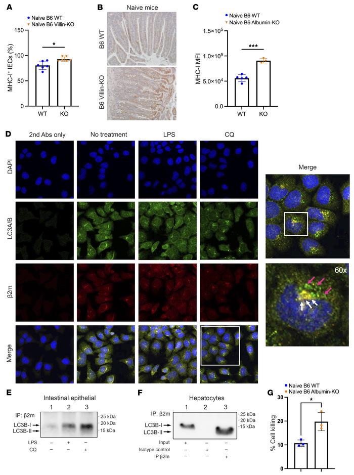 IECs from Villin-Cre+ Atg5–/– mice show increased levels of MHC-I compar...