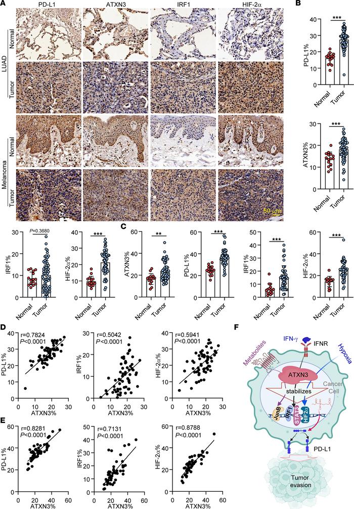 Elevated ATXN3 expression and its positive correlation to PD-L1 and its ...