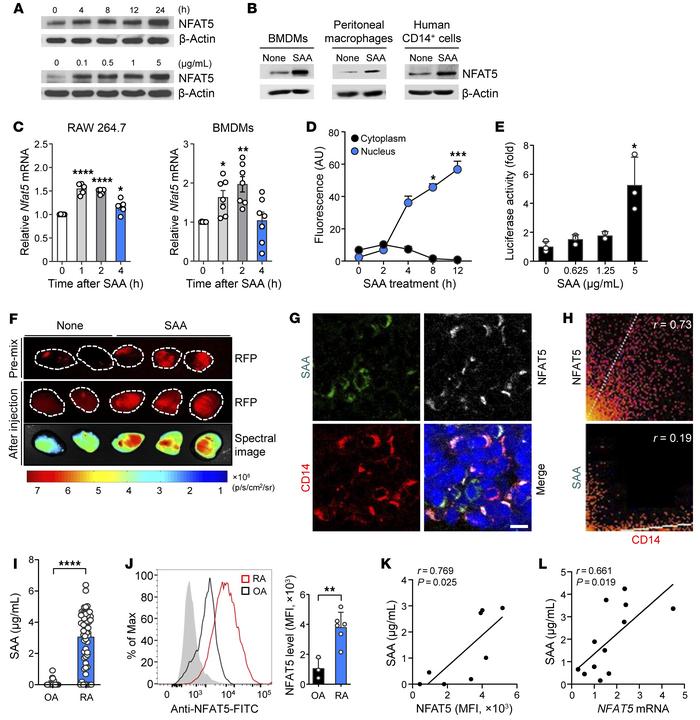 SAA-induced upregulation of NFAT5 expression and activity in macrophages...