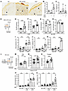Patients with SLE and murine SLE models show evidence of cutaneous lymphati