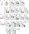 Improving lymphatic flow reduces cutaneous photosensitive responses in SLE