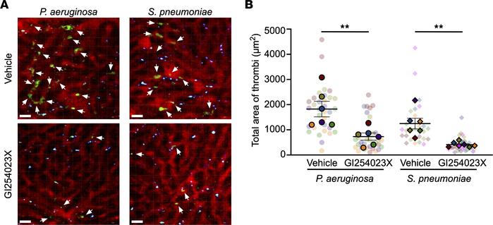 ADAM10 mediates platelet aggregation.
(A) Representative 2-photon images...