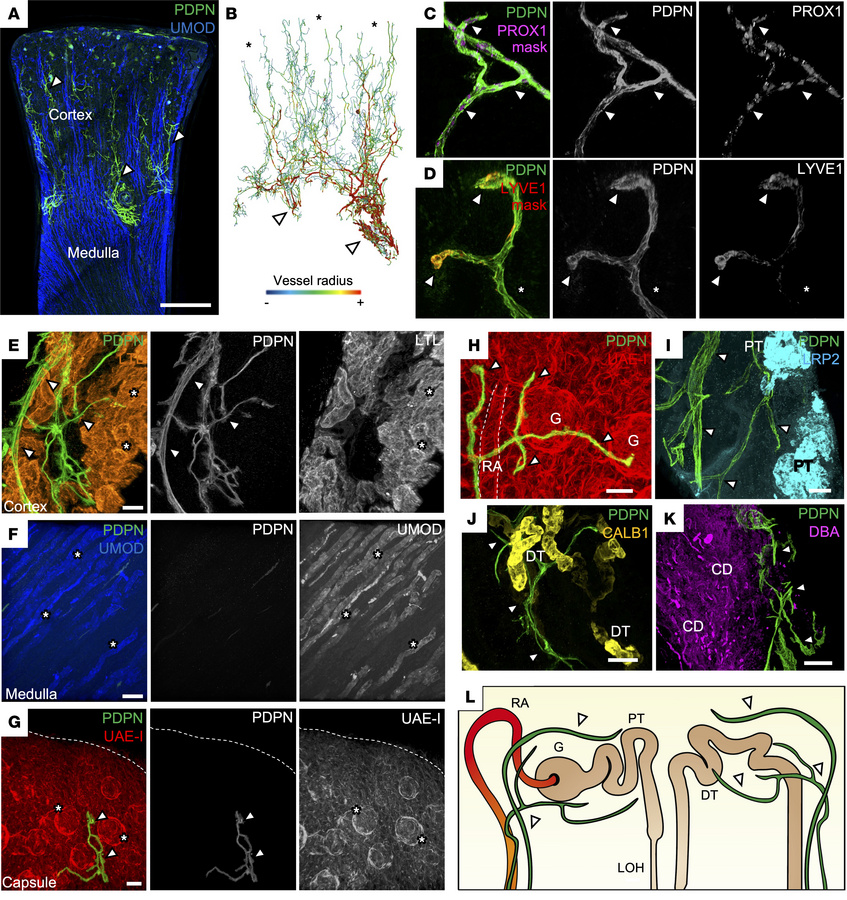 3D imaging of lymphatics and their spatial relationships in the human ki...