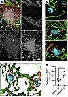 Spatial association between lymphatics and maturation of tertiary lymphoid