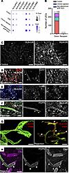 Donor lymphatics upregulate MHC class II molecules and represent a target f