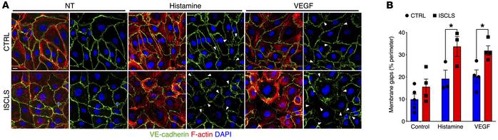 Structural correlates of impaired barrier function in BOECs.
(A) Represe...