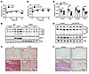 IL-13/IL-13R1 regulates beige adipocyte recruitment.