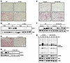 Adult mice deficient in IL-13 signaling exhibit impaired responses to β3-ad
