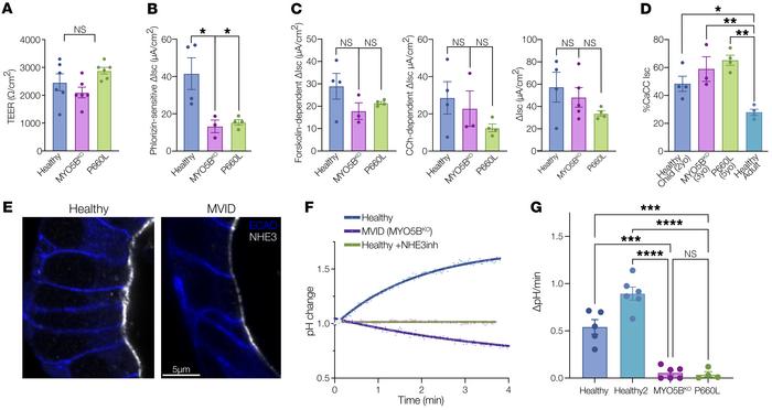 Loss of sodium absorption and normal chloride secretion in MVID patient ...