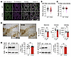 Reduced DAergic terminal density in DAT-I312F/D421N+/+ mice.