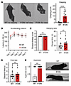 DAT-I312F/D421N+/+ mice exhibit clasping behavior and kyphosis.