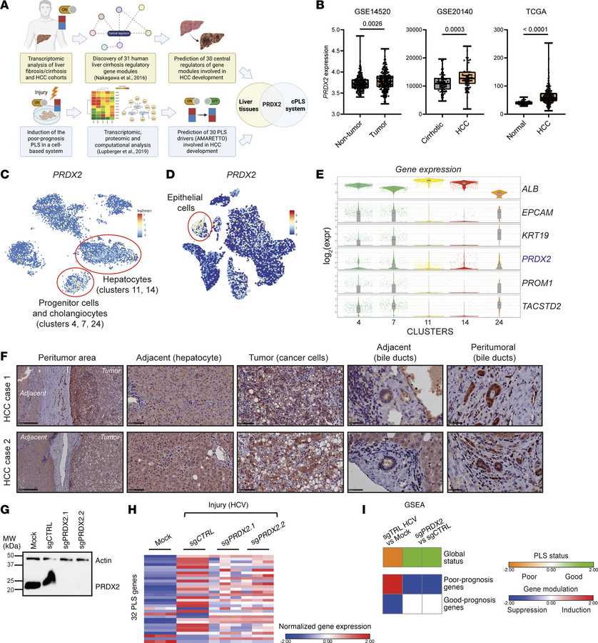 PRDX2 expression is associated with HCC in patients.
(A) Identification ...