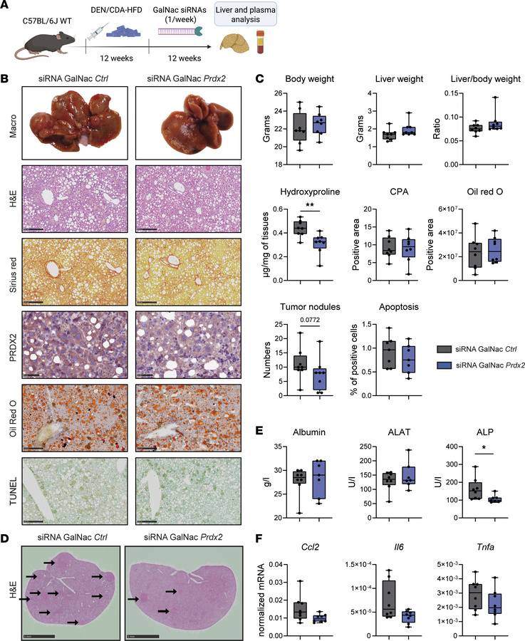 
Prdx2 KD in hepatocytes prevents HCC development in a preclinical mouse...