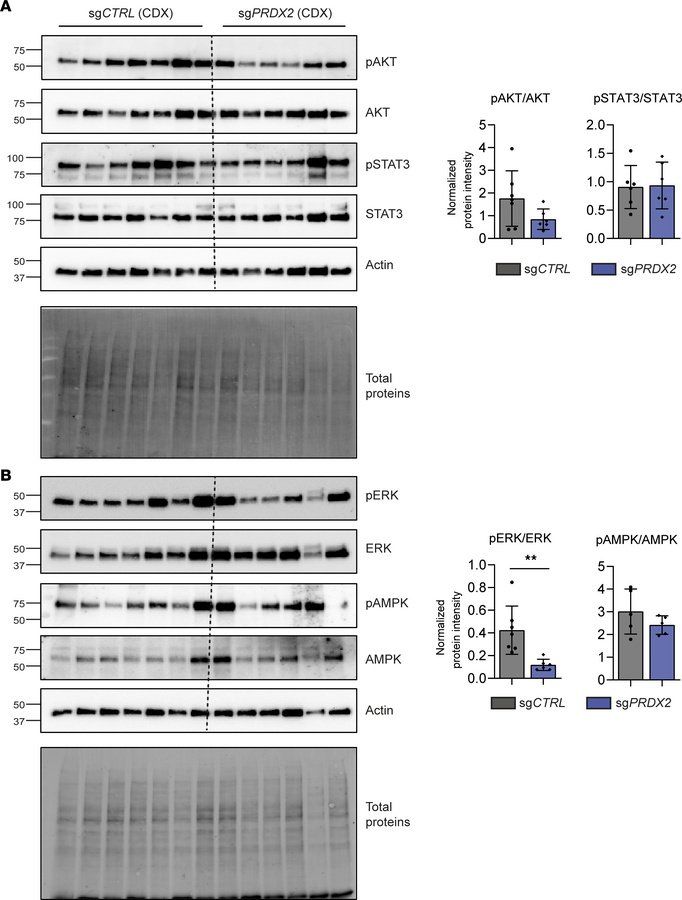 
PRDX2 KO slows down tumor progression in a CDX model by suppressing pro...