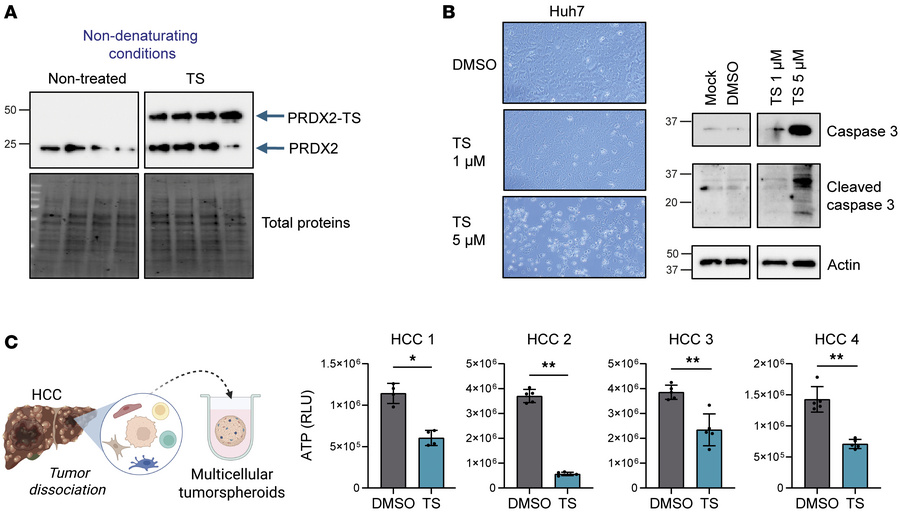 Targeting PRDX2 using thiostrepton induces Huh7 cancer cell apoptosis.
(...