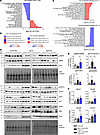 PRDX2 is involved in HCC development by improving lipid metabolism and tran