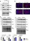 Targeting PRDX2 improves lipid metabolism and suppresses procarcinogenic si