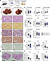 Prdx2 KD in hepatocytes prevents HCC development in a preclinical mouse mod