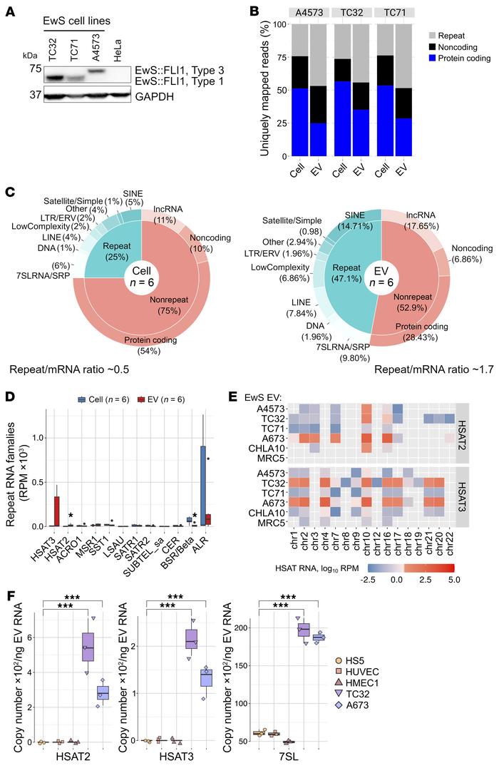EwS EVs are enriched with retroelement and pericentromeric RNAs.
(A) Imm...