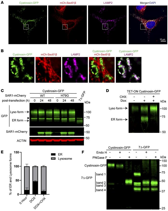 The ER and lysosome forms of cystinosin-GFP.
(A) Fluorescence microscopy...