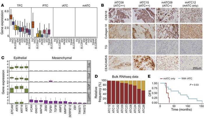 Characteristics of epithelial cell subtypes in thyroid cancer.
(A) Box p...