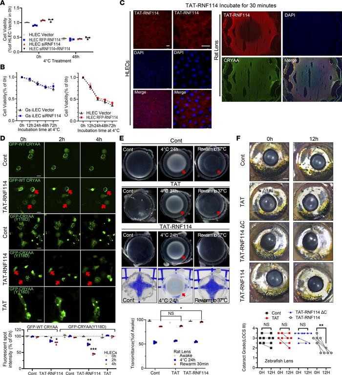RNF114 reverses cataracts in non-hibernators.
(A and B) CCK8 assay was p...