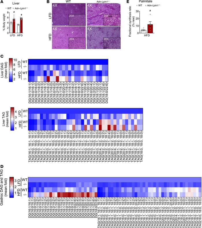 Loss of adipocyte Lpin1 leads to severe hepatic lipid accumulation.
Eigh...