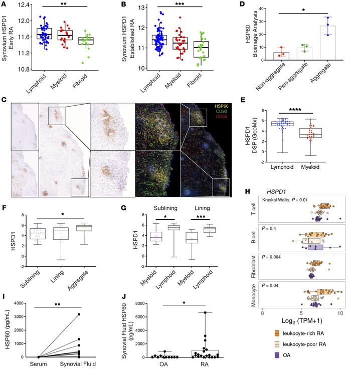 HSP60 expression in synovial tissue and SF of patients with RA.
Synovium...