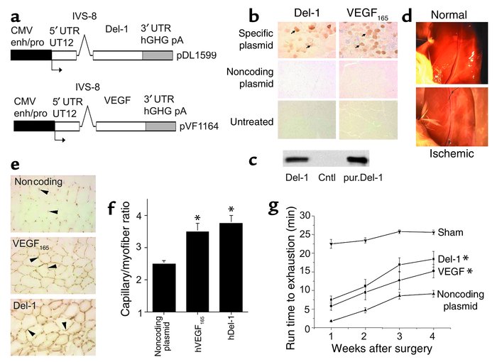 Del-1 promotes angiogenesis and restores function to murine ischemic mus...