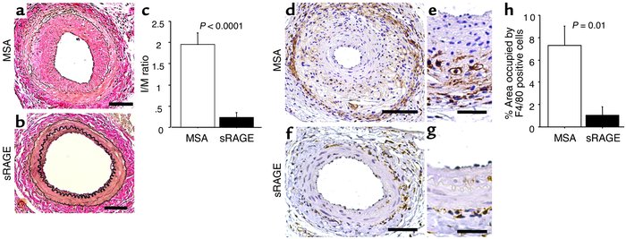 Effect of sRAGE on neointimal expansion in apoE null mice. (a–h) ApoE nu...
