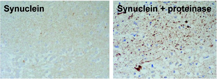 While Neumann and coworkers have demonstrated protease-resistant synucle...