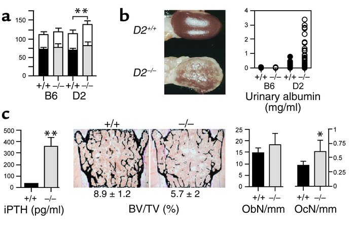The ectopic calcification in DBA/2-Ahsg–/– mice leads to high blood pres...