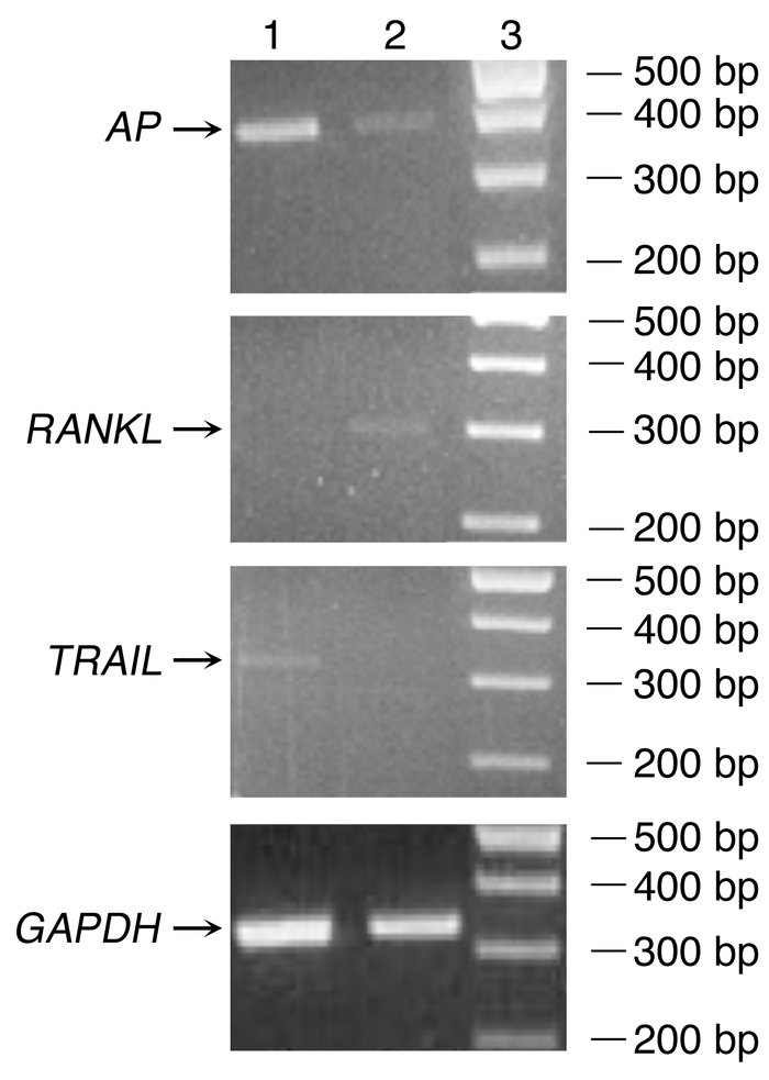 Demonstration of the lack of TRAIL expression in cells sorted by FACS us...