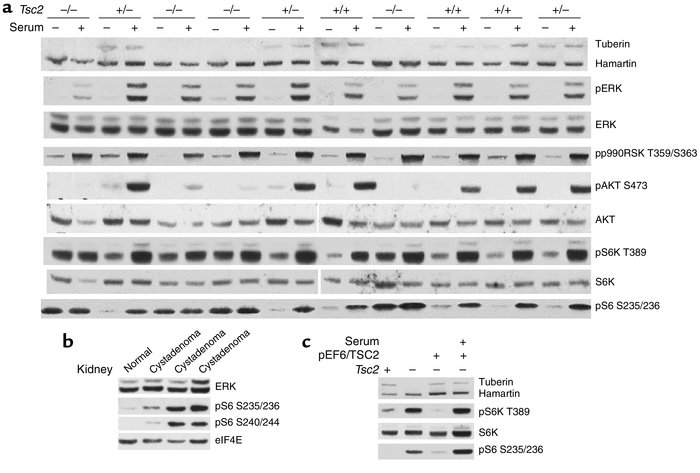 Growth signaling in TP53–/–Tsc2–/– MEFs and Tsc2+/– mouse cystadenomas. ...