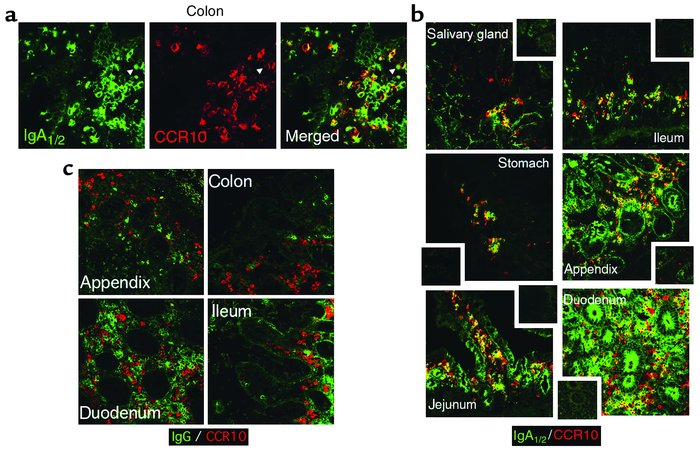 CCR10 is expressed by mucosal tissue IgA plasma cells. Epithelial tissue...