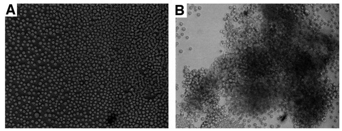 Phase-contrast microscopy of tumor cells cultured with IgG purified from...