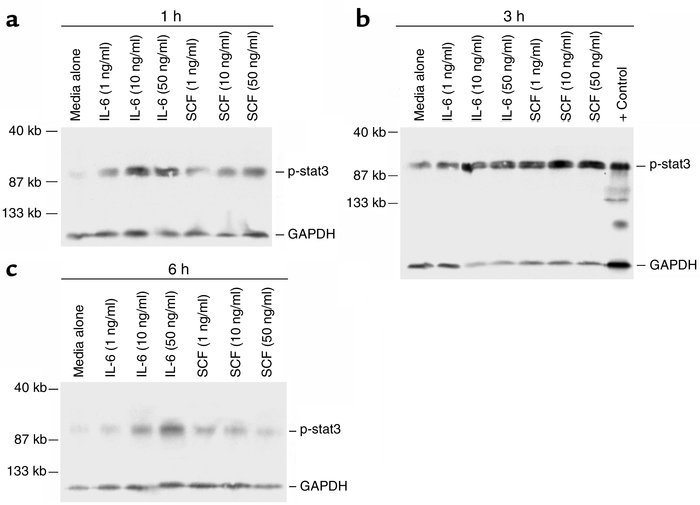 Representative Western blot analysis for cytosolic p-stat3 levels in pri...