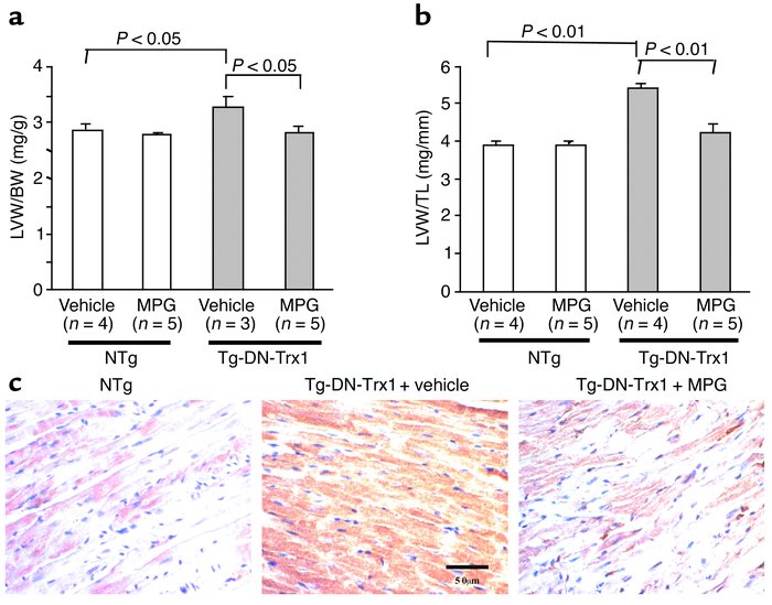 The effect of antioxidant treatment on base-line cardiac hypertrophy in ...