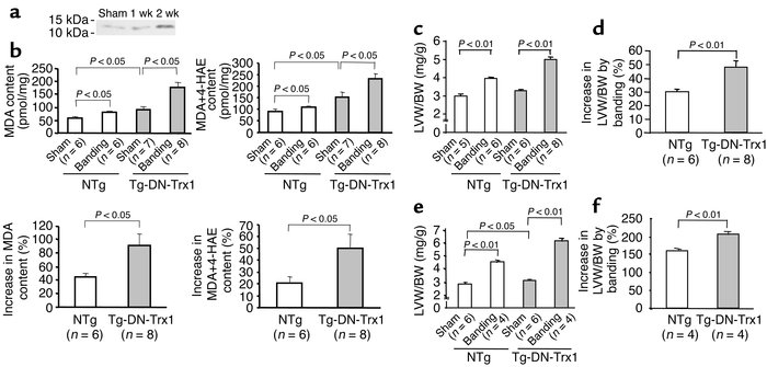 Tg-DN-Trx1 mice and NTg littermates were subjected to either transverse ...